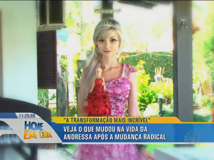 Barbie Humana Brasileira Comenta As Suas Mudancas Dioguinho Blog Sempre Em Cima Do Acontecimento